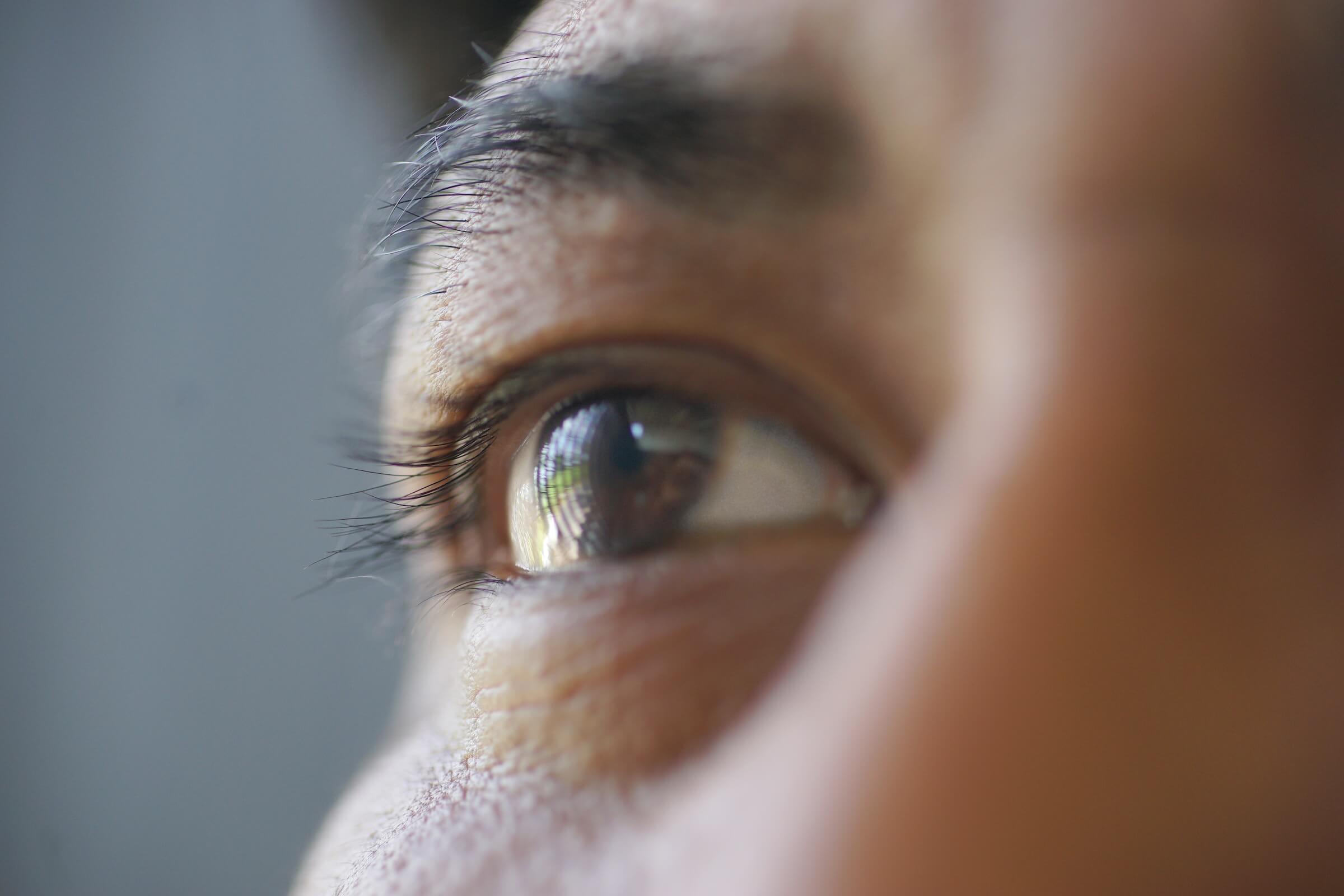 Emianopsia cause
