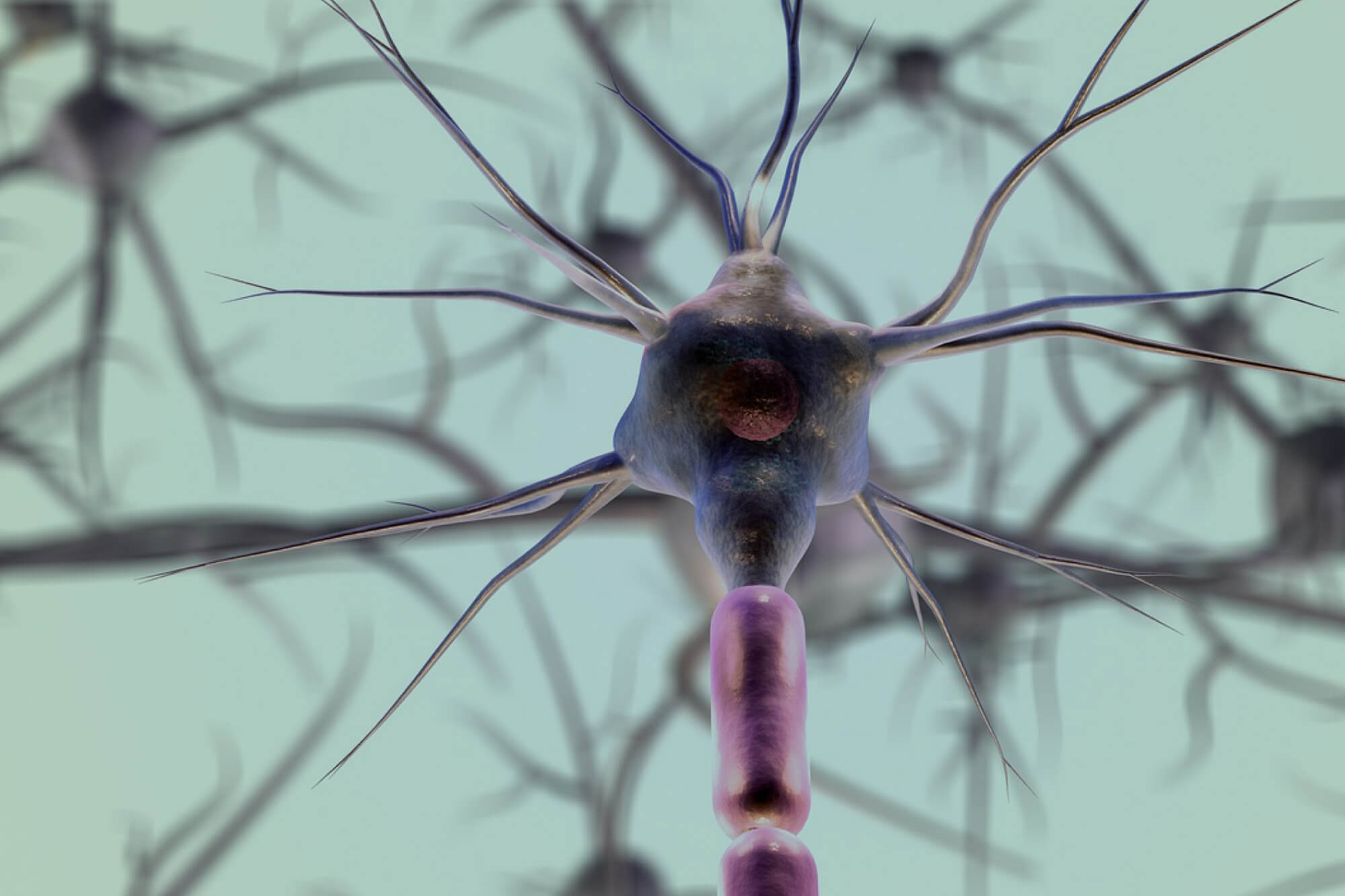 Demenza frontotemporale cos'è, sintomi e riabilitazione Emianopsia Demenza frontotemporale cos'è, sintomi e riabilitazione Emianopsia