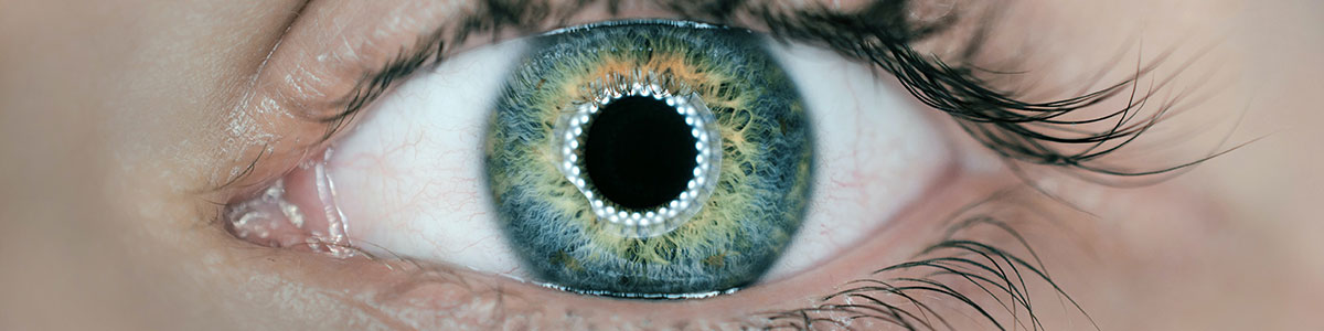 aura visiva
